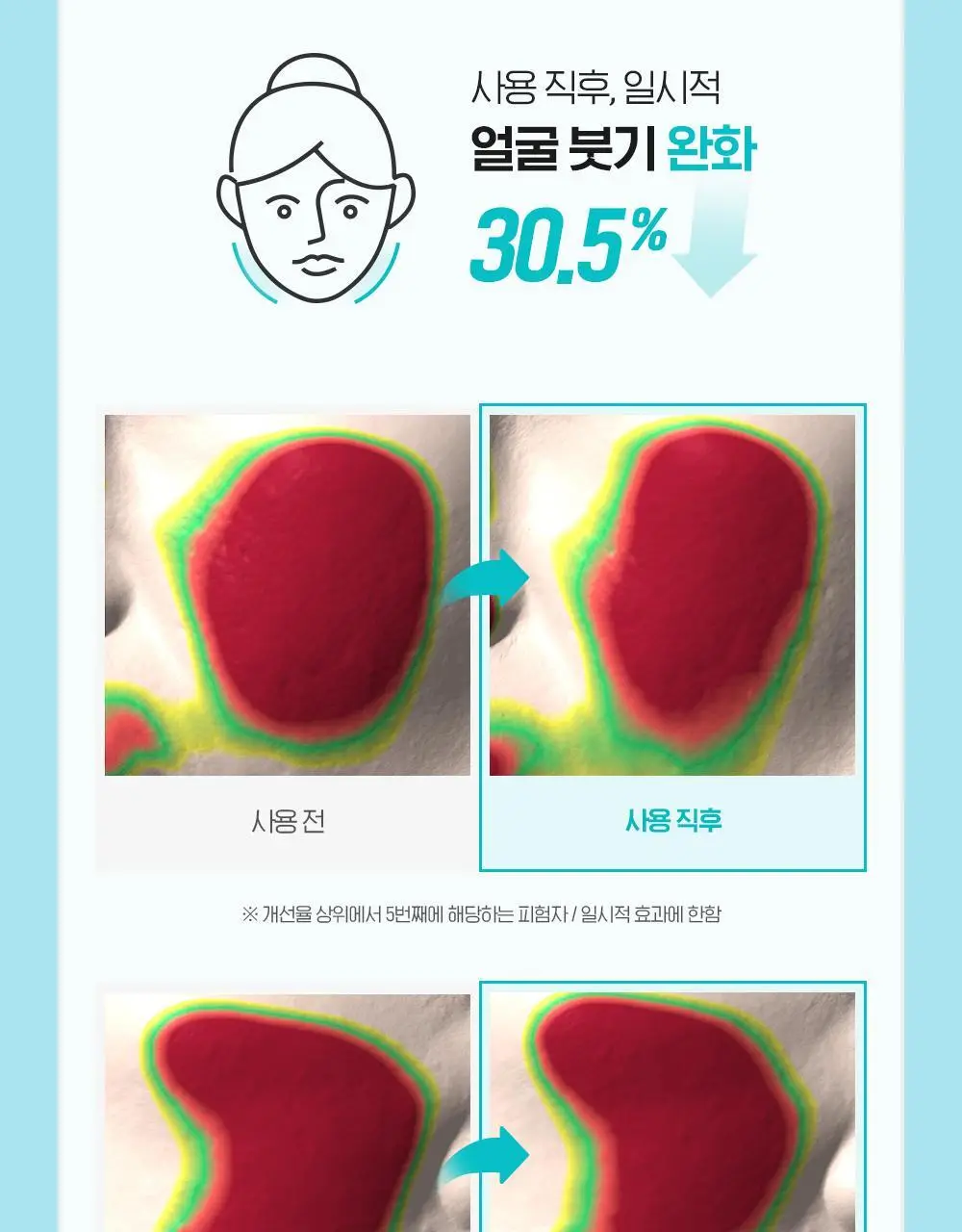 [화잘먹크림] 빌리프 아쿠아 밤 프로즌 크림 50ml 기획 (3종 중 택 1) 상세페이지 27